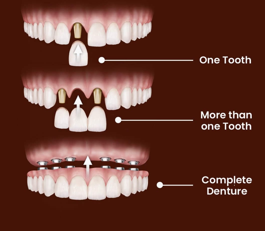 Smile INN Dental Care Karathod